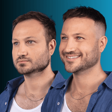 Σύστημα Μαλλιών MACOhair® 2