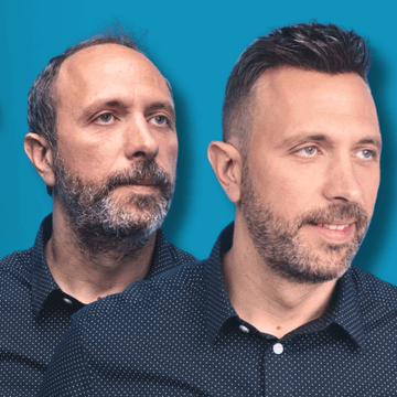 Σύστημα Μαλλιών MACOhair® 5